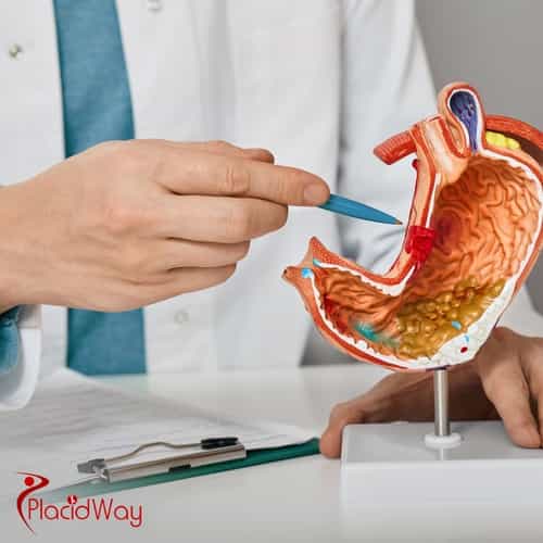 Gastric Bypass in Mexico: Safe, Cost-Effective Surgery for California Tourists